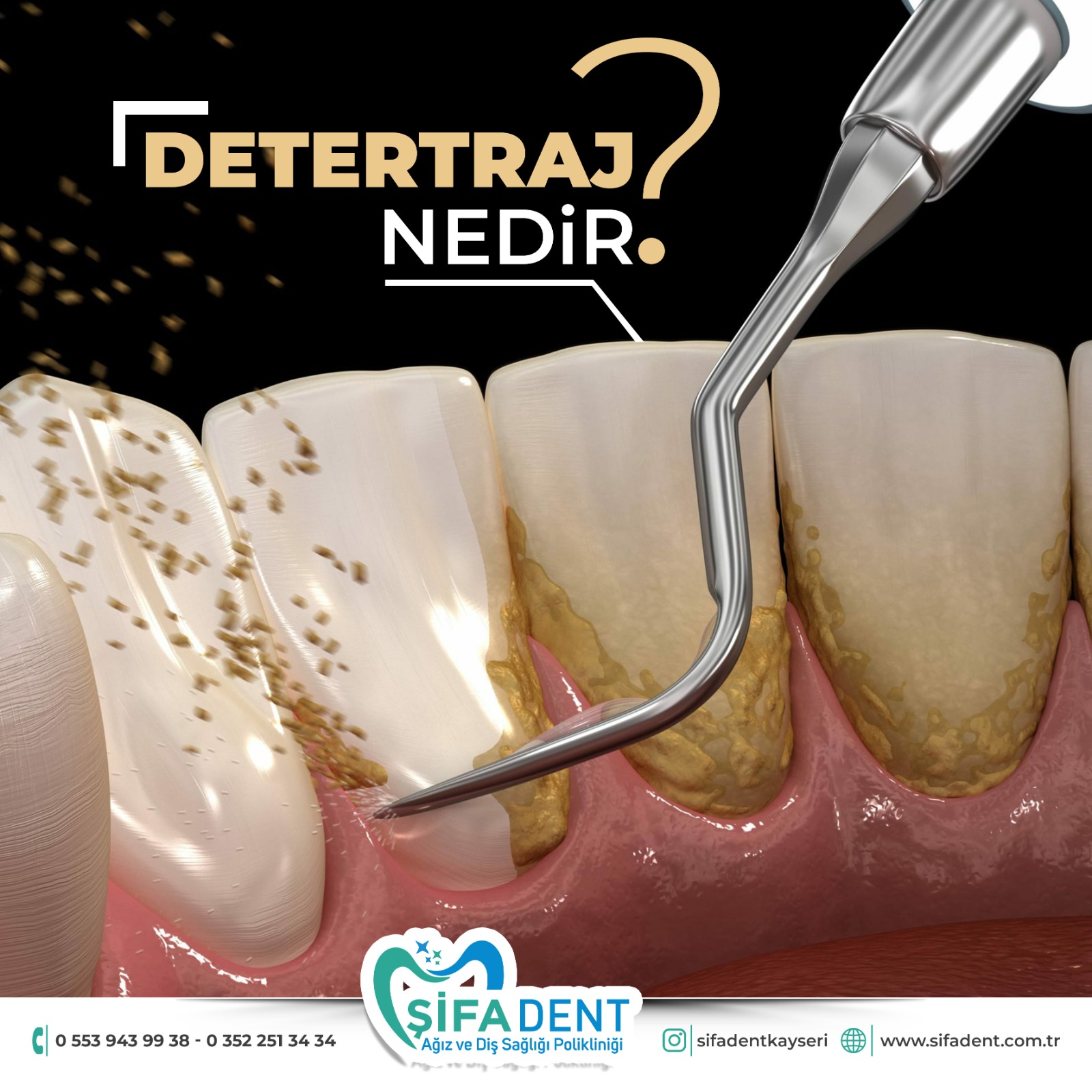 DETERTRAJ NEDİR?