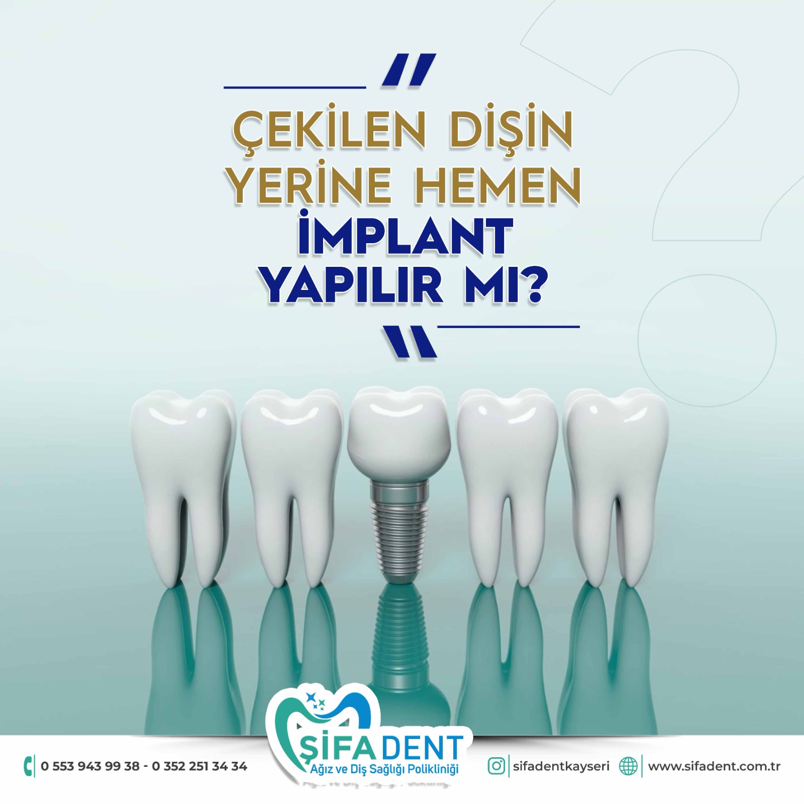 ÇEKİLEN DİŞİN YERİNE HEMEN İMPLANT YAPILIR MI ?